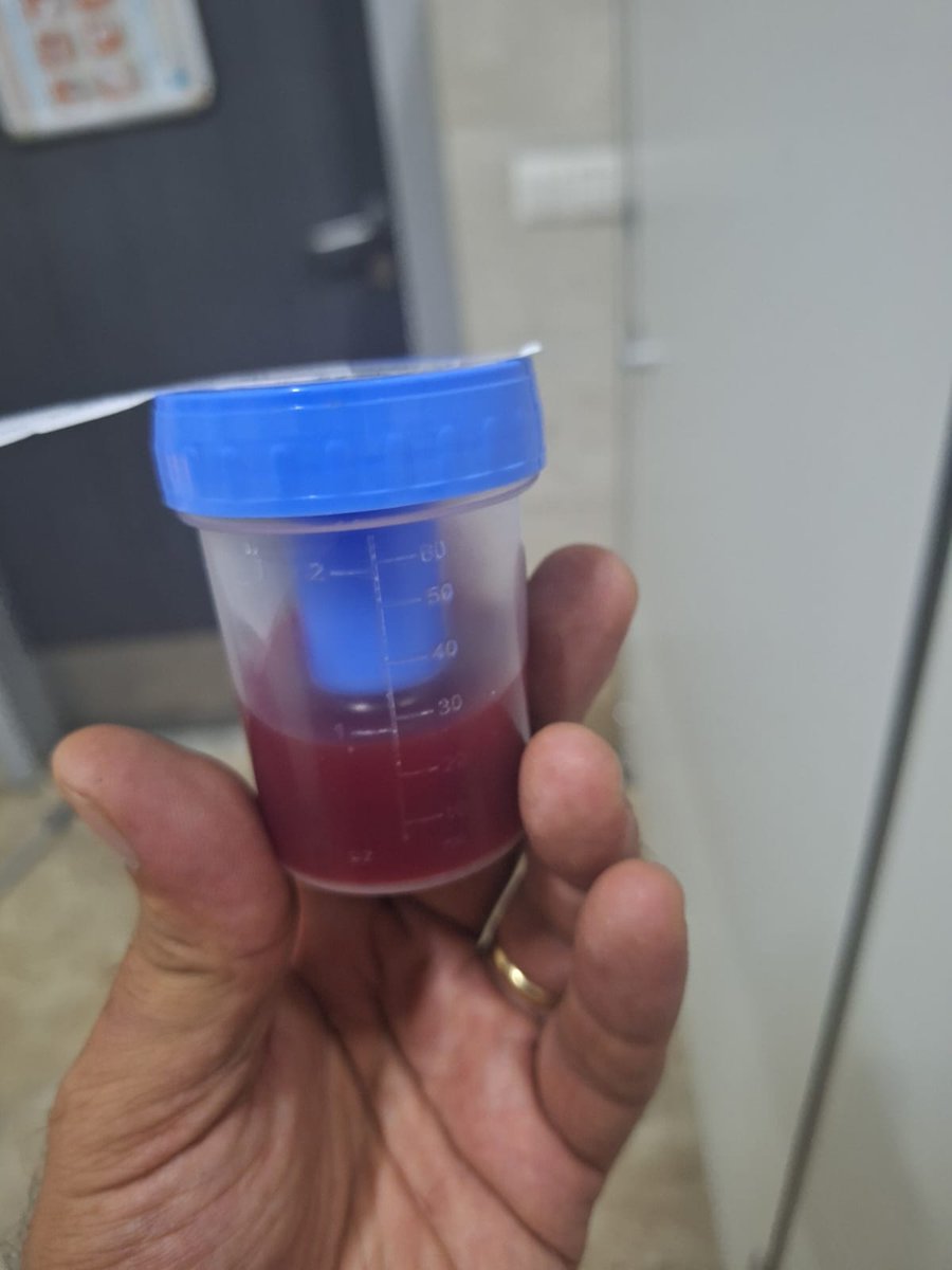 cansevencahit's tweet photo. İdrarında yogun kan gelen  acil servisteki hatasını hiçbir müdahale yapmadan, dahiliyedeki nöbetçi olmasına rağmen uyuklayan  doktorun konsultasyon kapatıp  taburcu eden hastane bahcelievler devlet hastanesidir.#saglik #türkiye @RTErdogan @eczozgurozel https://t.co/prGfra3xaY
