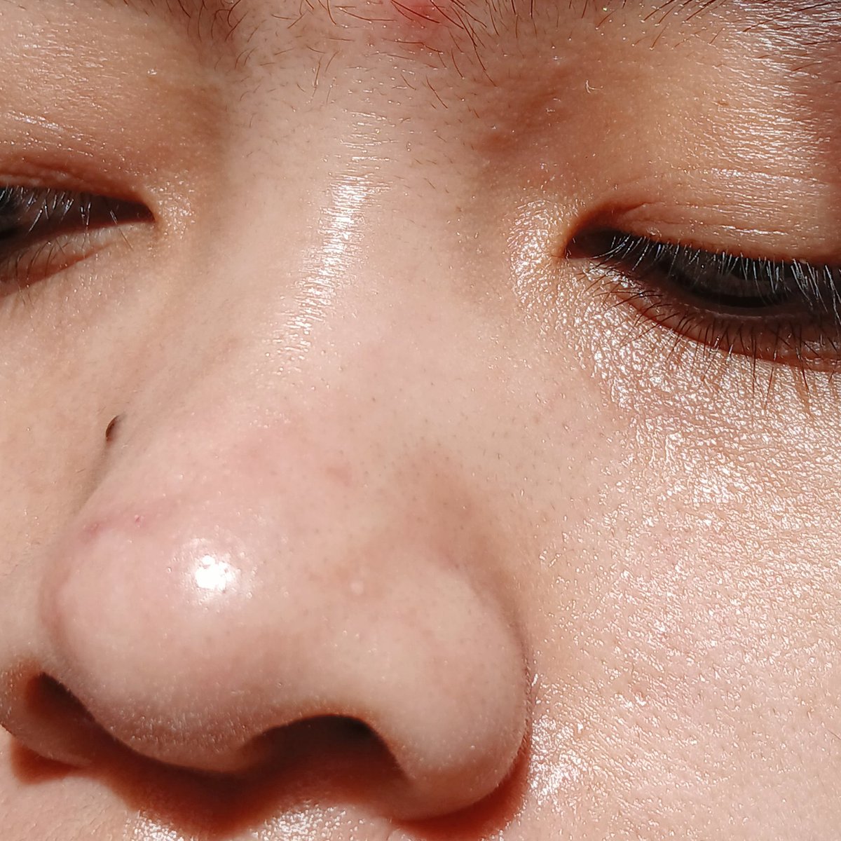 Ga nyangka ada produk lokal sebagus ini buat hilangin komedo dan minyak berlebih 😣🫵

Mau sungkem dulu sama ini produk ga perlu lagi effort pencetin hidung buat hilangin komedo di hidung  🙇‍♀️