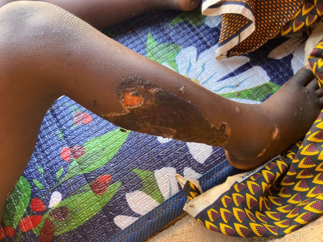 In the Zike community of Bassa LGA, Plateau State, Moses Asebe endured unimaginable loss. Her eldest son, Jerry, aged 14, was dragged away and killed. Her two younger sons, Jacob, 3, and James, 10, who had hidden in their room, were thrown into a fire and burned alive. Moses and