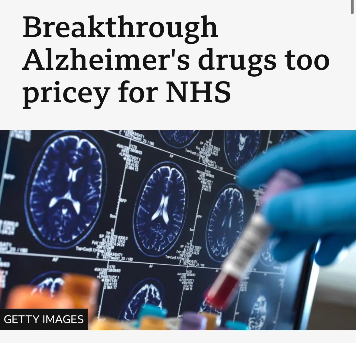 ZiaYusufUK's tweet photo. The NHS says there’s no money for breakthrough drugs for British people.

Because they’re prioritising ‘Directors of Lived Experience’ on £110k salaries.

Insane. https://t.co/bZ39ZHtZfJ
