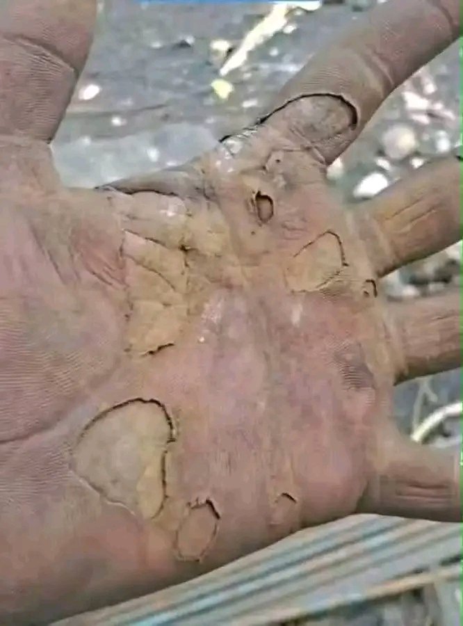 chrissimonzenko's tweet photo. Some might think the guy has worn a pair of gloves,no that's a bare hand trying his best to support his family..Men really go through a lot!
. https://t.co/IDLUlSzsBn