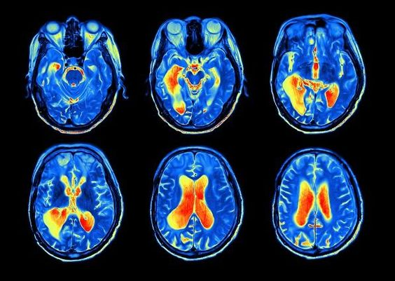 Tengo 40 años.  

El estrés me controló durante años así que recurrí a la neurociencia.  

Después de +1.200hrs estudiando a atletas de élite, CEOs y psicólogos, mi kit de habilidades ahora está repleto de poderosos trucos neurológicos.

Aquí los 7 más top que cambiarán tu vida: