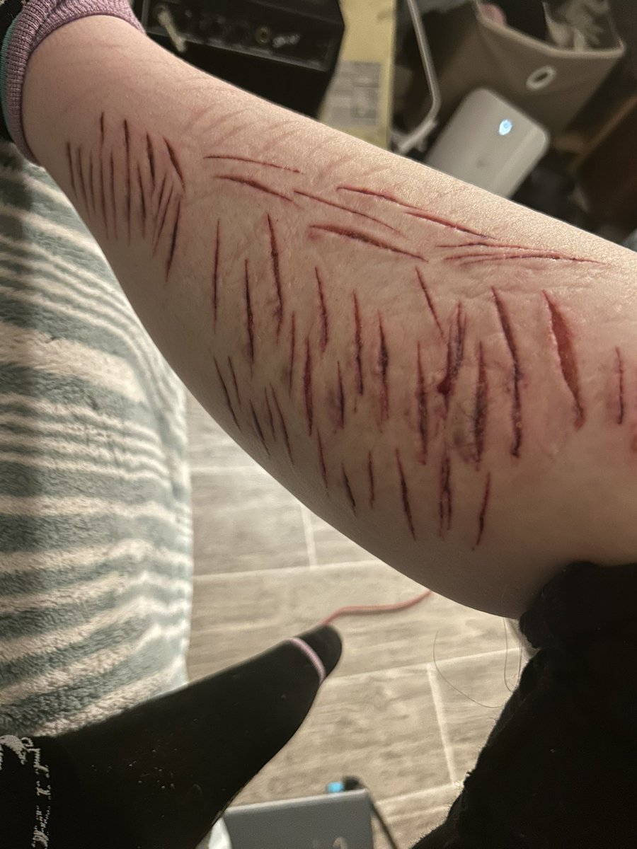 d3adrabb1tt's tweet photo. Ew https://t.co/4NKZU8iaNp