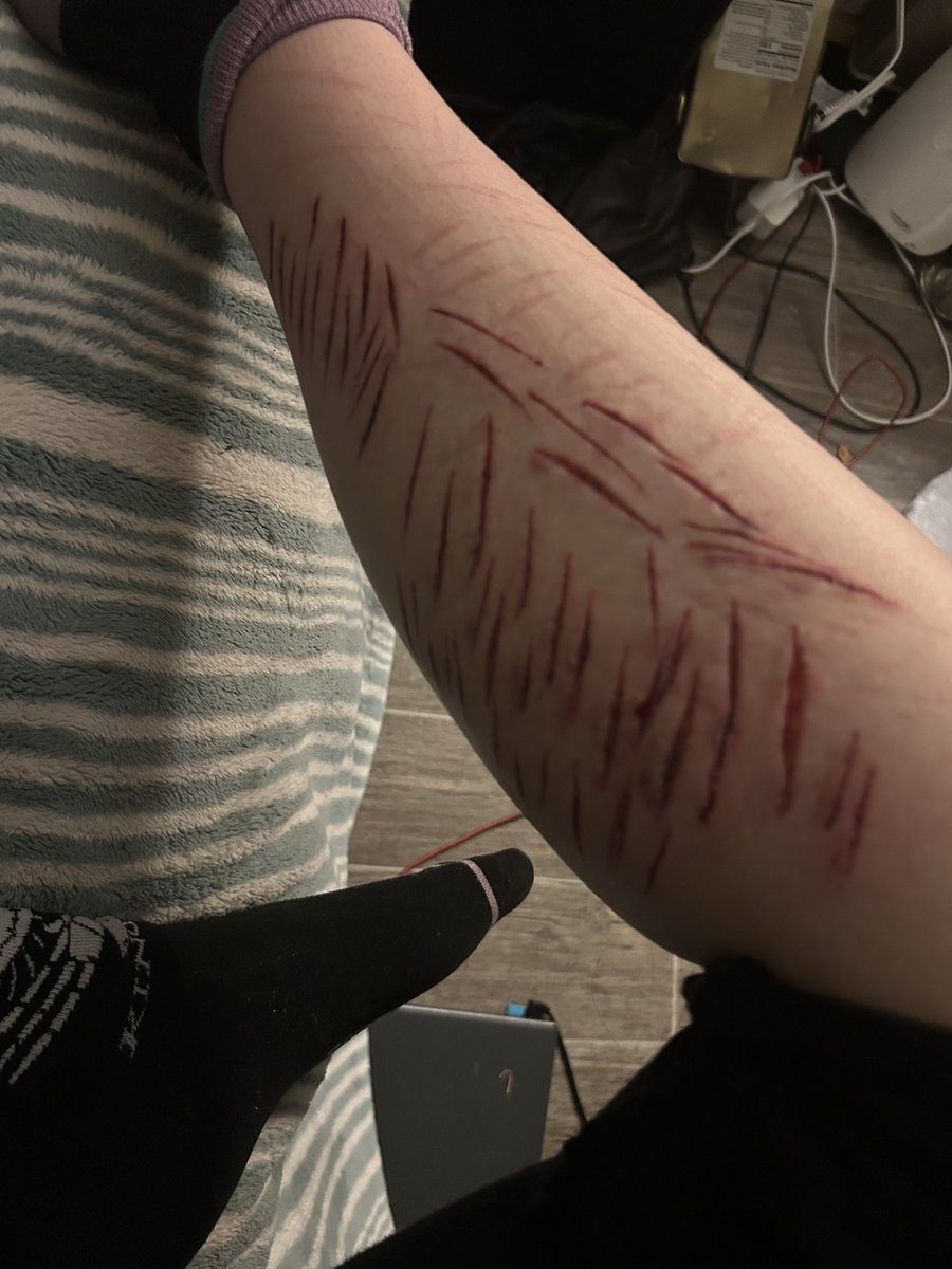 d3adrabb1tt's tweet photo. Ew https://t.co/4NKZU8iaNp