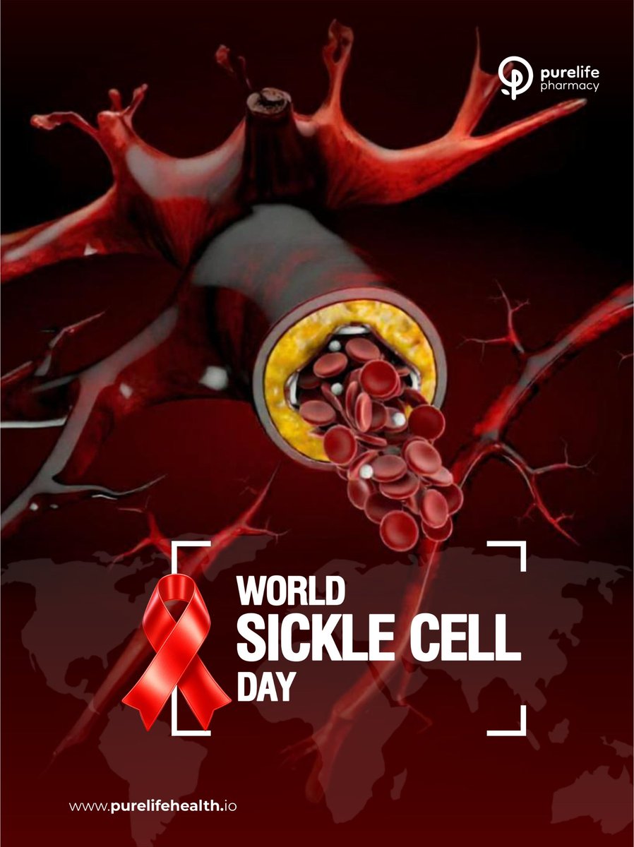 PurelifeNg's tweet image. Today, we recognize World Sickle Cell Day, a day to raise awareness about the challenges faced by individuals living with Sickle Cell Disorder.
#purelifehealth #purelifepharmacy #retailexcellence #sicklecellday #sicklecell #247pharmacy #pharmacyinlekki