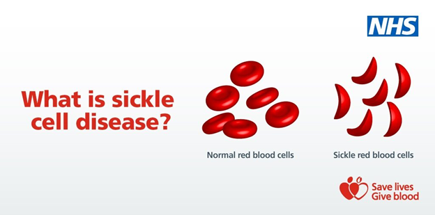 NHSBT Therapeutic Apheresis Services tweet media