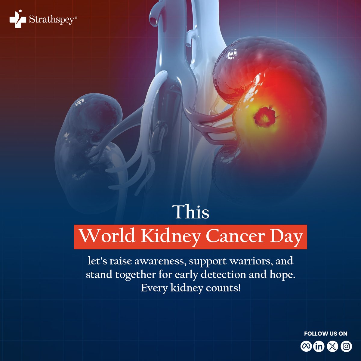 LabsStrathspey's tweet photo. 📷 World Kidney Cancer Day reminds us of the importance of vigilance, early diagnosis, and continued research.
Let’s stay informed.
#KidneyCancer #MedicalAwareness #Strathspey #StrathspeyLabs https://t.co/mSe68ktLvj