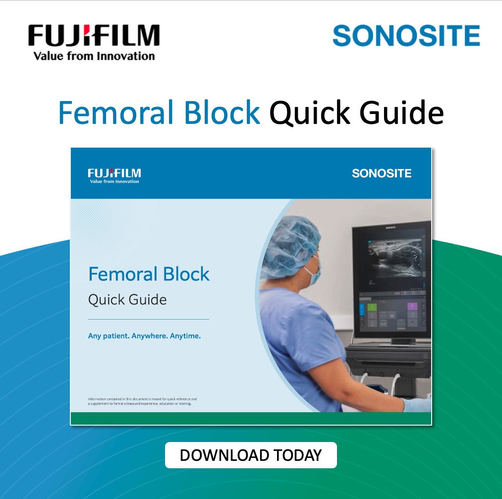 Need a quick reference guide for knee surgery patients?
Our Femoral Block Quick Guide is here. From sonographic images to needle approach tips, we’ve got you covered! Optimise post-operative care with just a few clicks.

Download the complete guide now: brnw.ch/21wTwcc