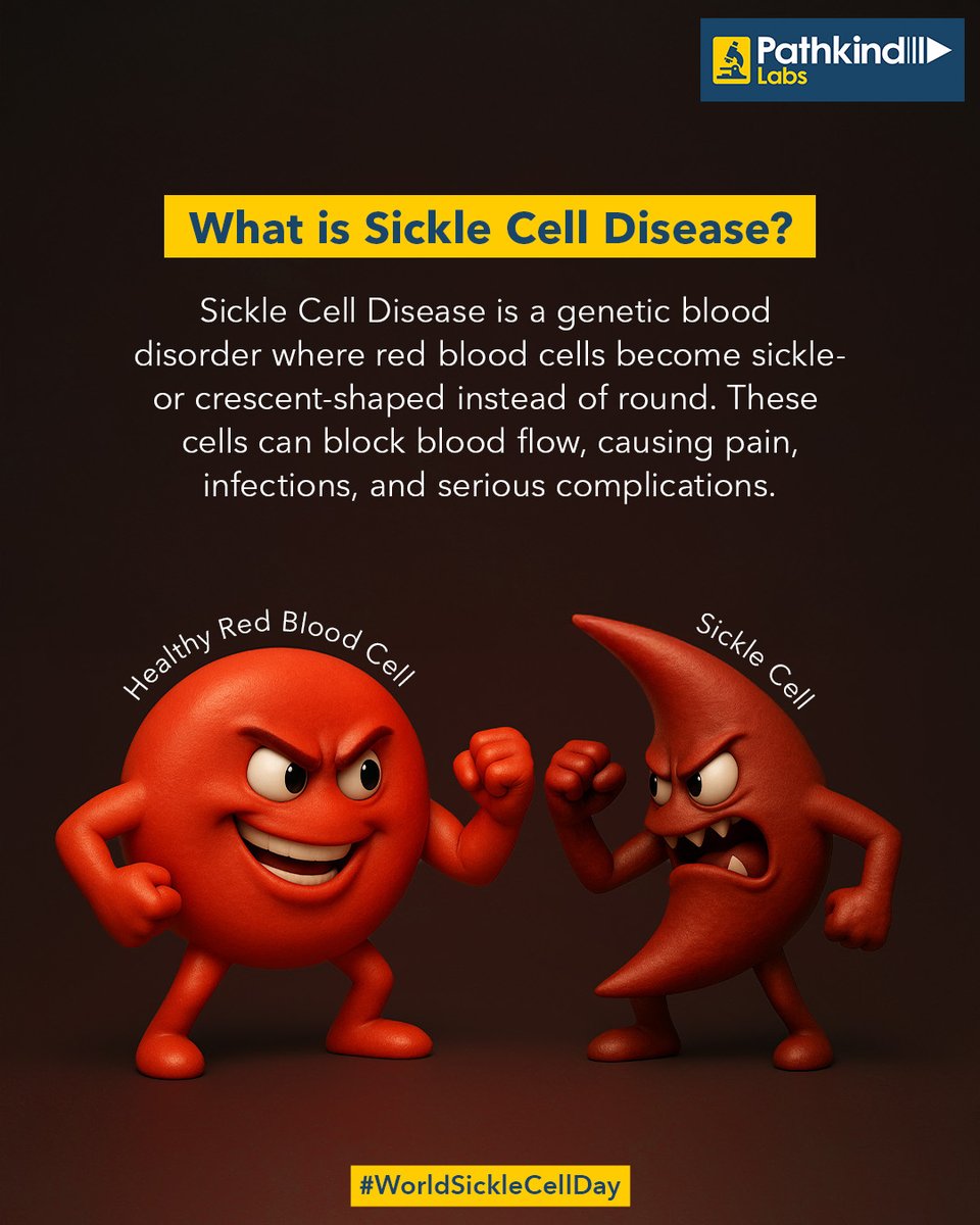 On World Sickle Cell Day, we stand in solidarity with the brave individuals living with Sickle Cell Disease and their families. Their strength and resilience in the face of this challenging condition are truly inspiring. ​

Let's take a moment to understand Sickle Cell Disease