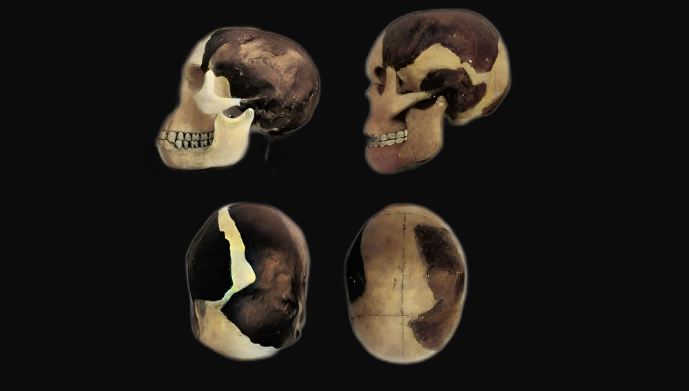 highlycited's tweet image. Piltdown Reconstruction by Smith-Woodward (Natural History Museum) vs Arthur Keith (Royal College of Surgeons).   Dr. Keith said that the NHM reconstruction was so bad that the creature &quot;would not be able to eat or breathe&quot; due to the way the jaw and skull were aligned.…