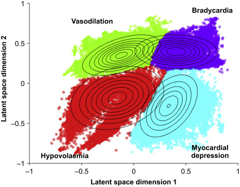 Deep learning models in anaesthesia remains to be clinically validated. Reliable benchmarking, open-source validation &amp; careful patient selection should be prioritised before using #AI for clinical decision making.

#artificialintelligence #hypotension

bjanaesthesia.org/article/S0007-…