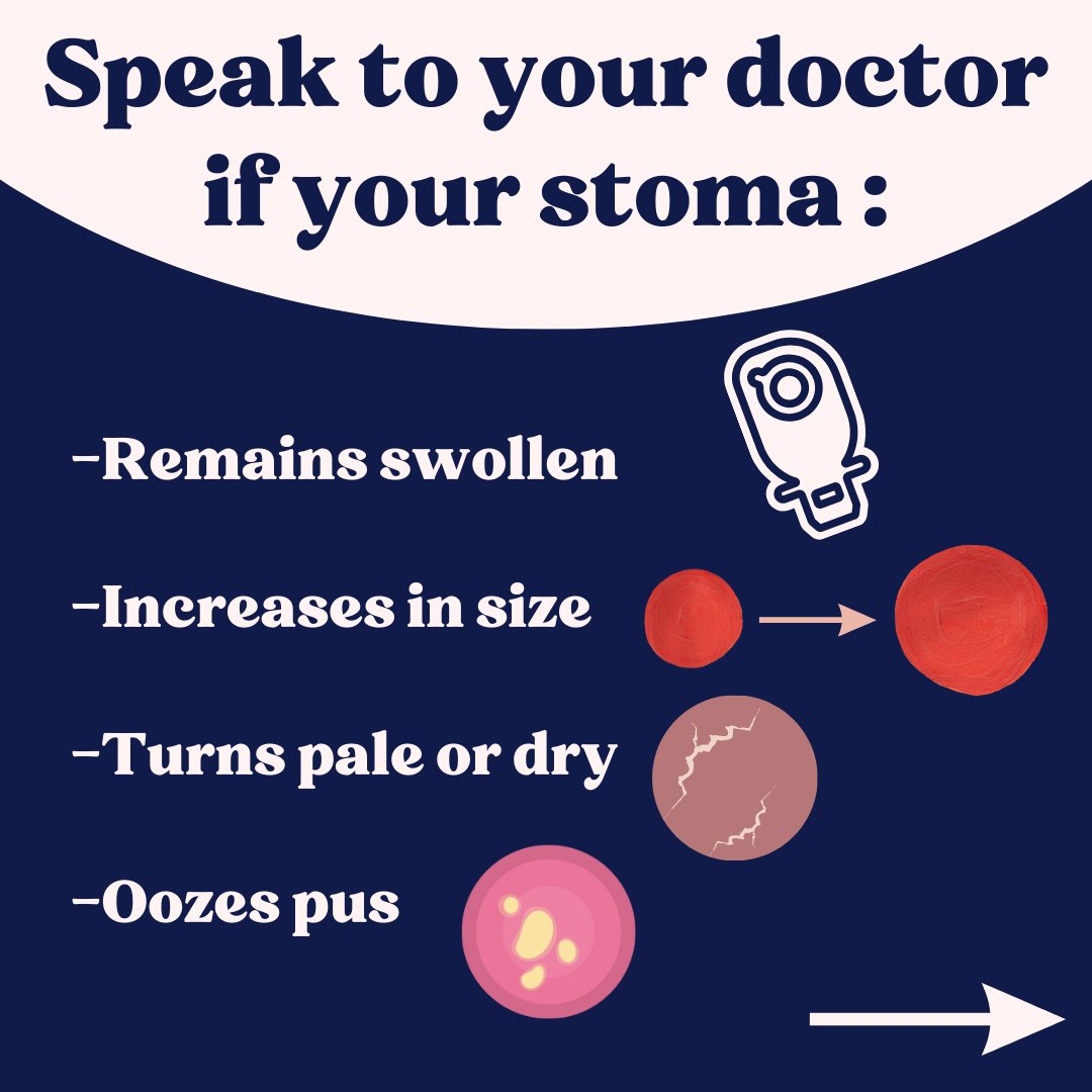 Ostiqueltd's tweet photo. When Should You Consult Your Doctor About Your Stoma?🤔  

Knowing when to reach out can make all the difference! 💬 

Stay proactive about your health and don’t hesitate if you notice any changes or concerns.   

Your well-being is a priority, so keep that communication open! https://t.co/26aybT8FDl