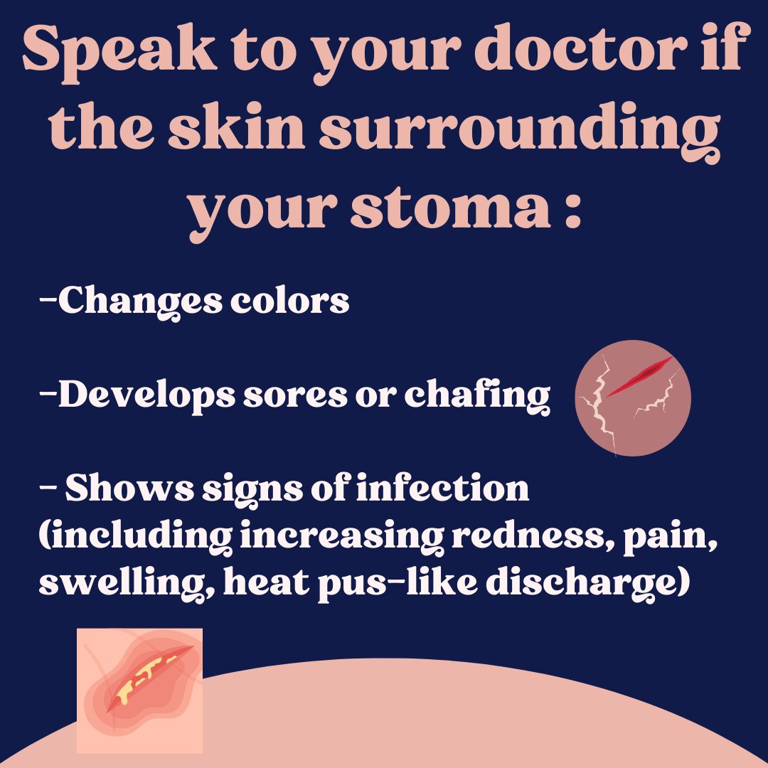 Ostiqueltd's tweet photo. When Should You Consult Your Doctor About Your Stoma?🤔  

Knowing when to reach out can make all the difference! 💬 

Stay proactive about your health and don’t hesitate if you notice any changes or concerns.   

Your well-being is a priority, so keep that communication open! https://t.co/26aybT8FDl