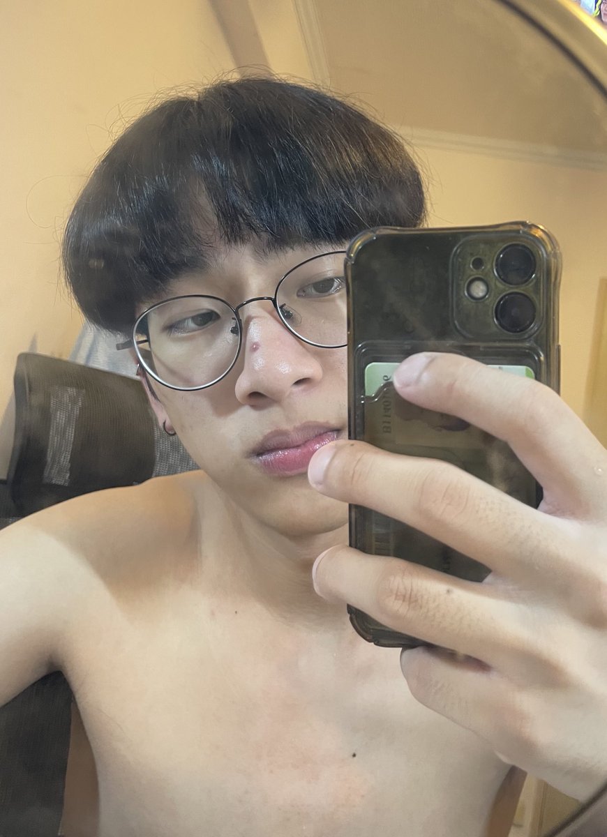 怎麼好像每個暑假都會在鼻子長巨痘==