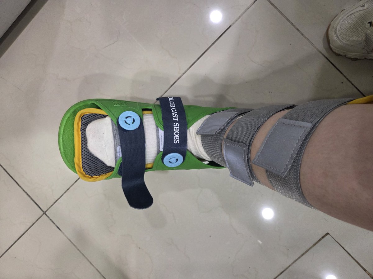 간만의 소식 업뎃~
발 다쳐서 반깁스 신세입니다.
모두 조심하세요~