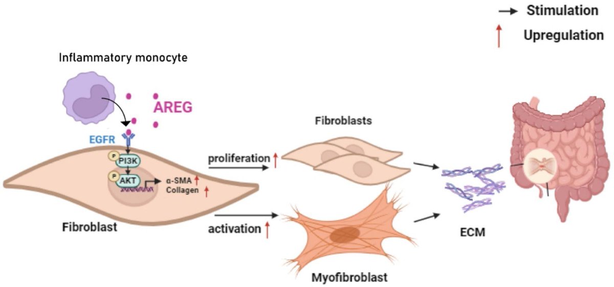 MucosalImmunol's tweet image. Intestinal fibrosis during Crohn’s disease can be mediated by inflammatory monocytes via amphiregulin and PI3K/AKT mucosalimmunology.org/article/S1933-…