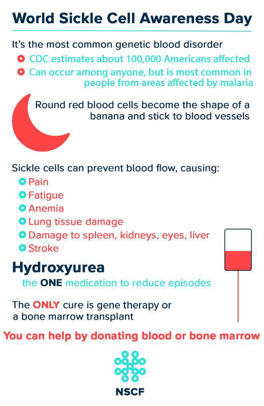 Today is #WorldSickleCellDay to increase public awareness for the challenges faced by people living with #sicklecell disease (SCD) which impacts100,000+ people in the U.S. and 20 million people worldwide. Support NSCF today! #WSCD2025 #research #stemcells nationalstemcellfoundation.org/donations/