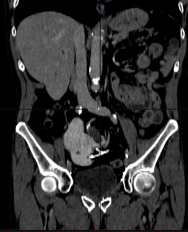Guido Giusti tweet media