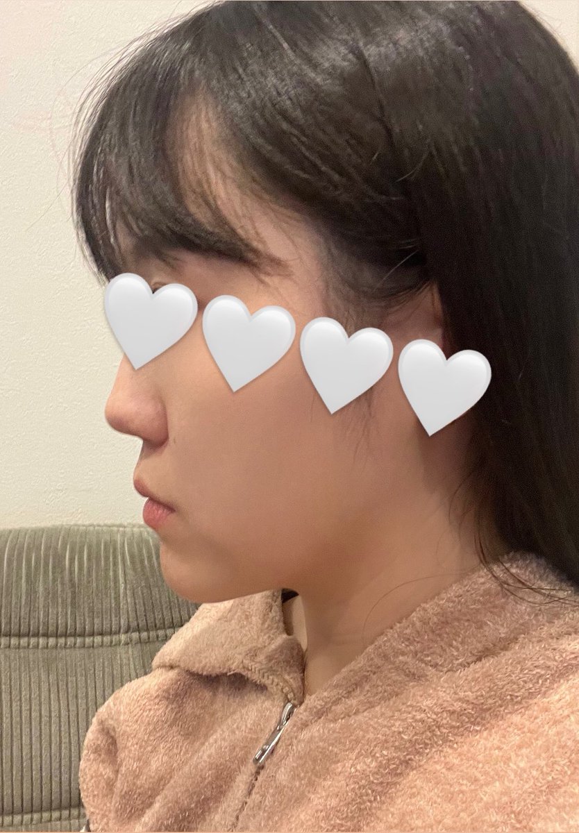 🐕@骨切り二重修正DT中 tweet media
