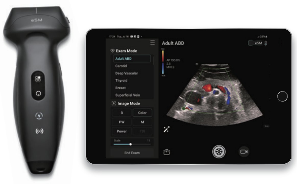 Whole-body scanning with confidence

With its portability, affordability, ease of use, and high efficiency, this handheld ultrasound system allows for rapid diagnosis and treatment and helps to improve patient outcomes.

By integrating multiple applications, TE Air e5M caters to
