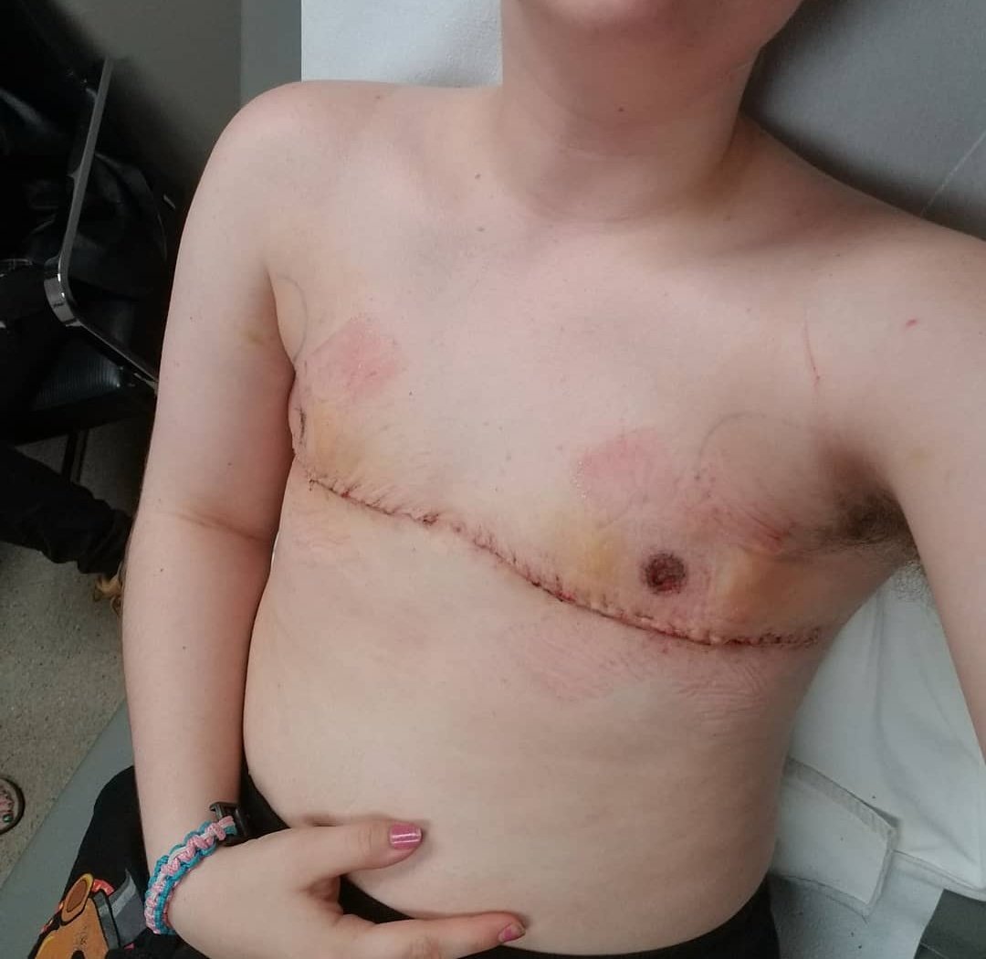 when you hear Democrats crying about "gender affirming care" and "trans kids" today remember that this is what they want. it happened to me, this is me at 14.