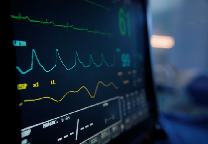 CardioCareToday's tweet image. Up to 1 in 4 ischemic strokes have no clear cause.

New research shows ICMs detect silent AF in 37% of cryptogenic stroke patients over 4 years—guiding life-saving anticoagulant therapy.

cardiocaretoday.com/post/insertabl… 
#Stroke #AFib #ICM #NeuroCardio