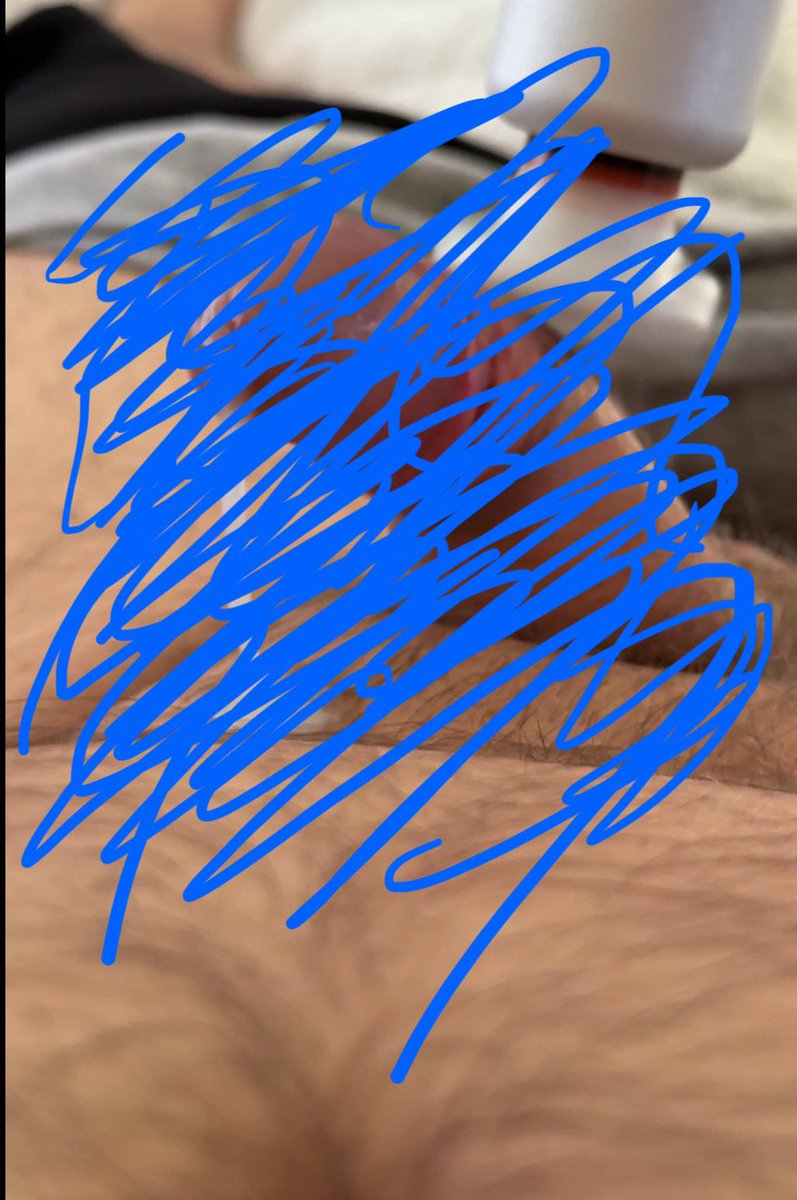 dlohayn's tweet photo. Massage gun fun.  #bear #hawaiianbear #cock #dick #cum #horny #nut 

https://t.co/7hIeBJZRUE https://t.co/XGpaR464ls