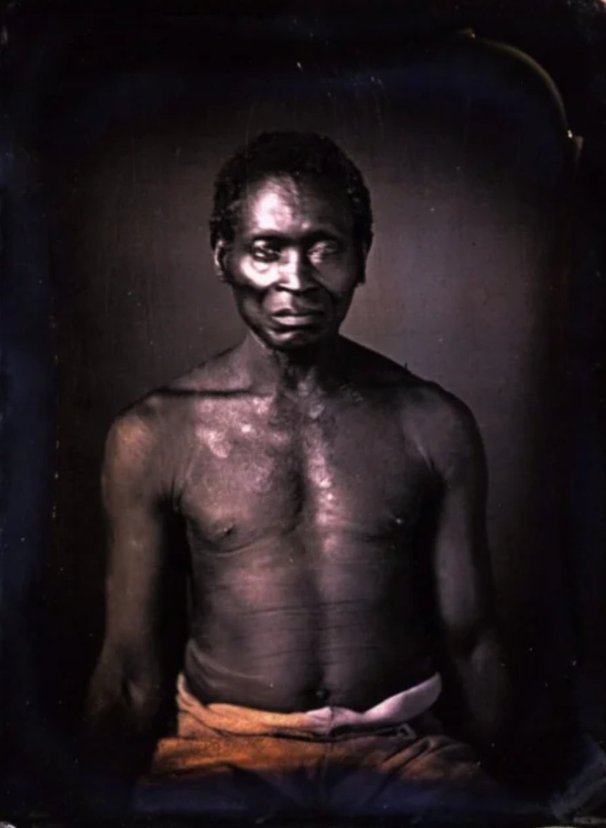 Fassena, un Mandingue originaire de l'actuel Mali, a été réduit en esclavage et photographié dans une plantation du comté de Richland, en Caroline du Sud, vers 1850.