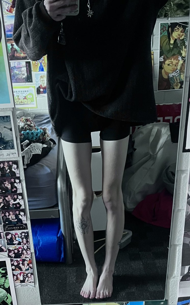 edibleorgans's tweet image. Morning organ nation. Sitting and waiting for another useless counselling service, yesterday way the worst day I’ve had in awhile. I feel like shit. Also leg bc 
#edtet #eedeetwt #bc #bodycheck #thinspo #meanspo #mealspo #ricecakestwt