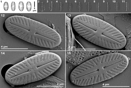 On the identity of the #diatom Mayamaea spirans (Hustedt) Lange-Bertalot (#Bacillariophyta, #Sellaphorinae, #Pinnulariaceae)
#taxonomy
doi.org/10.11646/phyto…
