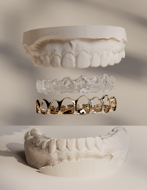 here's a tarnished grill... but look at the inside and how our protective layer said "🚫". #protectivemouthgrill easethebrand.com