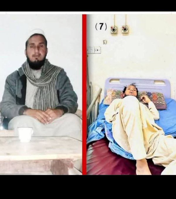 کیا وجہ ہے  9مئی میں گرفتار پی ٹی آئی کے نوجوان لوگ آزاد ہونے کے بعد آہستہ آہستہ مررہے ہیں؟
 یہ پی ٹی آئی کا 9نوا نوجوان ہے جو آج فوت ہوگیا