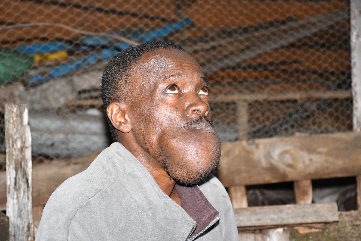 Savealifeorgke's tweet photo. 💔 Help Save Timothy Njoroge
He is in pain fighting a Chin tumour that’s stolen his smile and his peace. He urgently needs life-saving surgery 
#servicetohumanity 
 Let’s  give Timothy a second chance at life.
Click the link to donate and share
Widely 
 https://t.co/p3sg2JWiqY https://t.co/ofN2tfQwZv