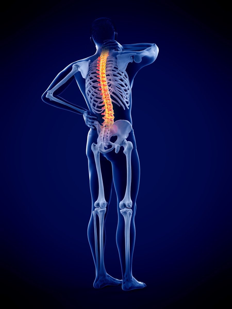 TheLancetRheum's tweet image. NEWS—Debate over interventional procedures for chronic spine pain
A clinical guideline published in @bmj_latest has sparked controversy for recommending against the use of common interventional procedures for chronic spine pain
Find out more 👉bit.ly/3Tmnwsb
