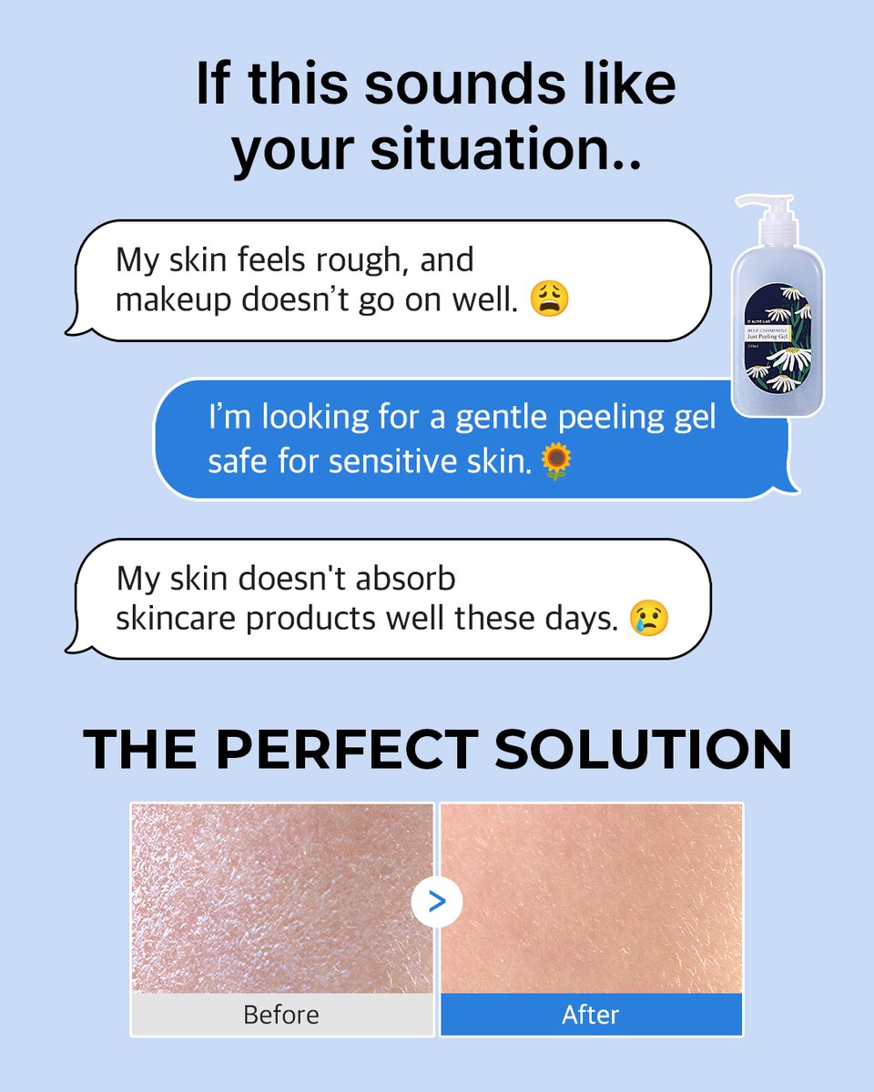 Is your makeup not applying smoothly? 🤔
Worried about exfoliating your sensitive skin? 😥
Skincare products not absorbing well? 😟

It's time for Blue Chamomile Just Peeling Gel🌻

Available on🛒
linkon.id/alivelab_global

#alivelab #peelinggel #skincare #kbeauty #koreanskincare