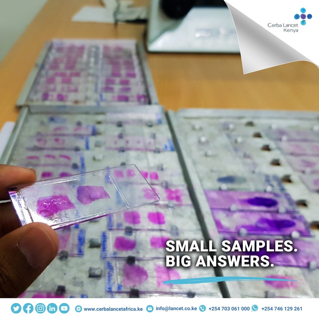 CerbaLancet_KE's tweet photo. ๐ฌ Service Spotlight: Cytopathology
We decode disease from a single cell.
From cancer detection to infection screening Cytopathology at Cerba Lancet Kenya means smarter, faster, and less invasive testing.
Book your test today!
#CerbaLancetKenya #DiagnosticsWithPrecision https://t.co/8C8Bi2G3ul