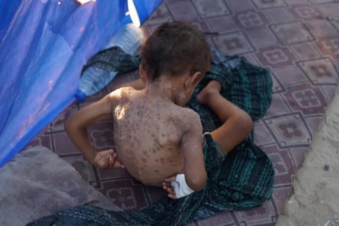 42ibrahimkarci's tweet photo. Gazze'nin özeti bu fotoğraftır..!!

#lemandergisikapatılsın Rusya'da
Meltem Cumbul / Volkan Korkudan 
Ebu cehil / Milletin Hakaret #deprem https://t.co/Lne7MGLA0c