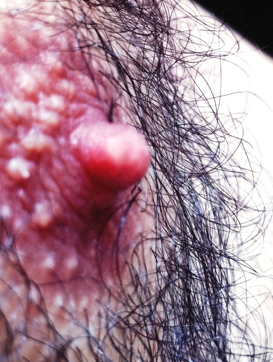 jack_porru's tweet image. appena uscito dalla doccia ho notato allo specchio che effettivamente ho un bellissimo semingione...
#doccia #specchio #semingione #capezzolo