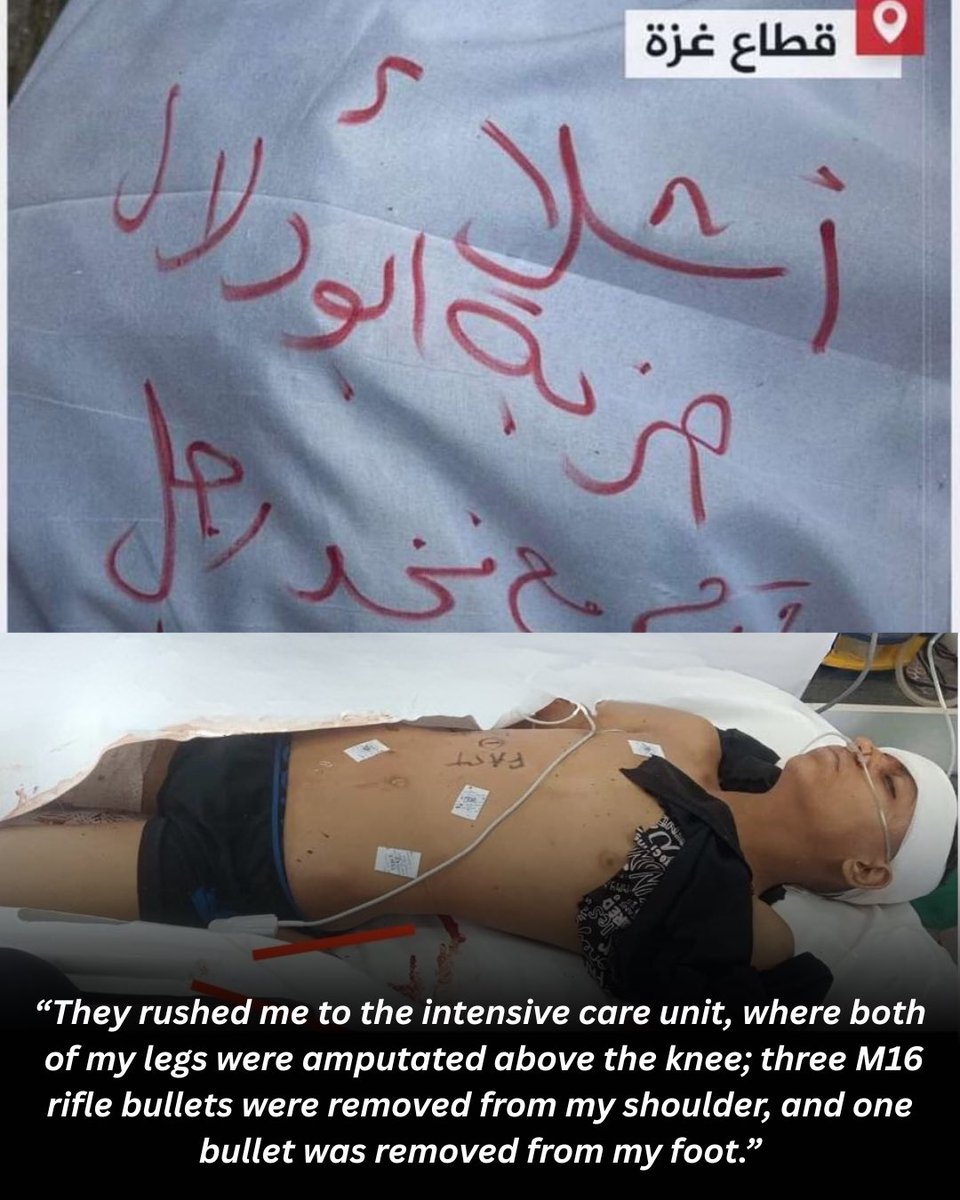 healpalestine_'s tweet image. Yazan underwent surgery yesterday for his amputated limbs and is now healing in the hospital. Yazan asked us to share his words with you all — his story, and his message:
“I went up to the roof of our house with my six cousins and my aunt to collect water, since we were running…