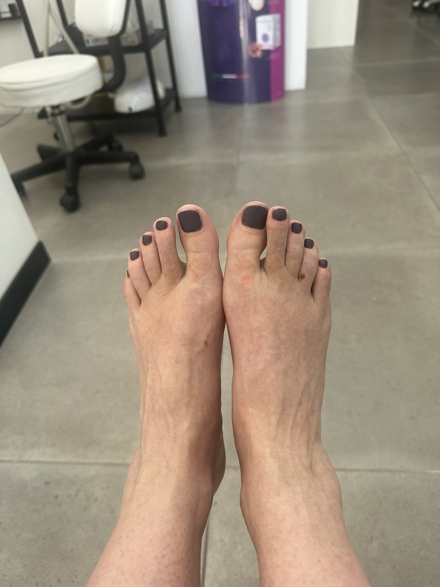 Here’s a picture of my “problematic”feet, for free! 💋