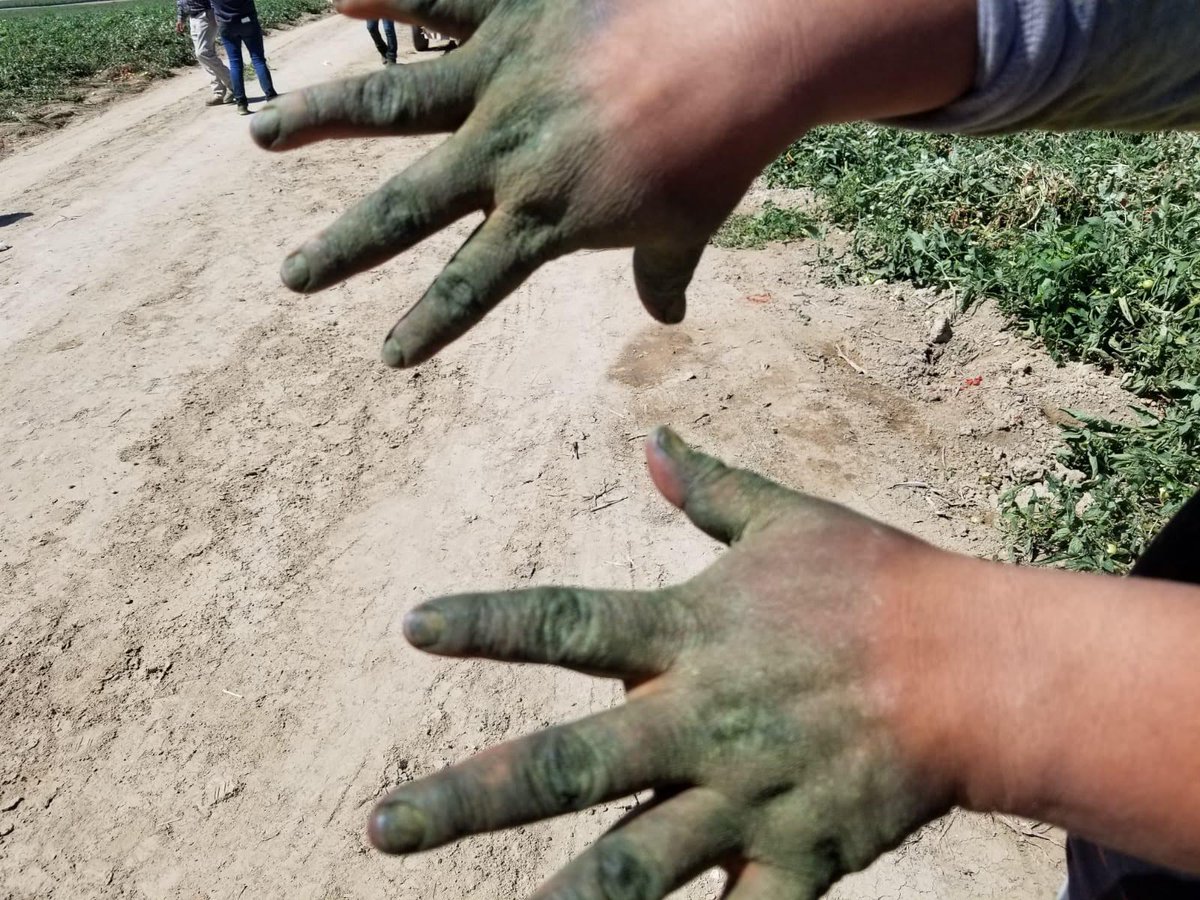 UFWupdates's tweet photo. These are the hands of a tomato picker. The harvest season in CA's Central Valley lasts around 5 months. Her hands are this color throughout. She washes her hands all the time, but they stay green during the season. It eventually fades off wants to season ends. #WeFeedYou
L https://t.co/Nhd28uMSL6