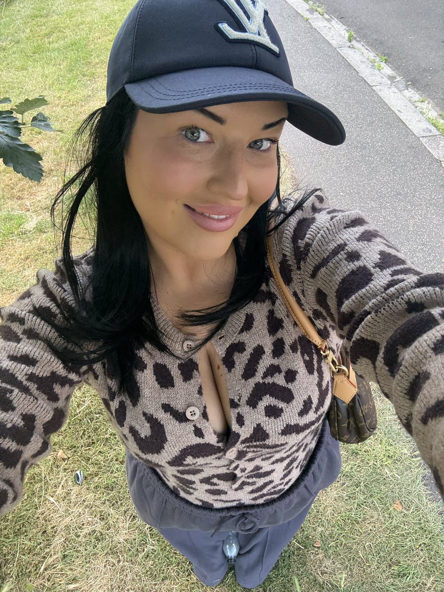 I finally have hair so happy!!