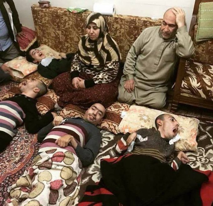 UK: The results of Abdul's cousin's marriage are beneficial to him, as he looks after them and doesn't need to work. The UK Govt gives him enough benefits to live a good life and perform hajj every other year, to thank Allah for jizya he receives from kaffirs.