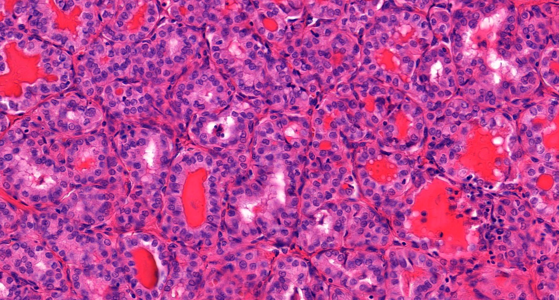 Annamária Ribiánszky, MD tweet media