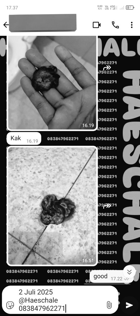 Ready obat pelancar haid / penggugur kandungan 1-6bulan, barang banyak mlimpah harga termurah ,testi buanyak . Konsul gratis ke wa 083847962271 #Misoprostol #gastrul #cytotec #penggugurkandungan #obatpelancarhaid #telatdatangbulan #haid #telat1bln #telat2bln #obatgugurinkandungan