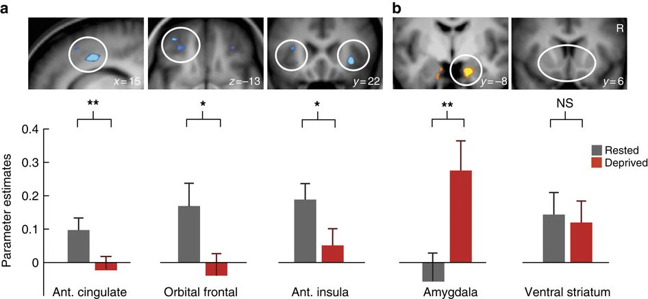 Sleep deprivation increases food desire in the brain.