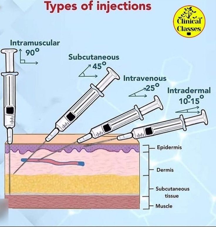 HowThingWork's tweet image. Types of injections