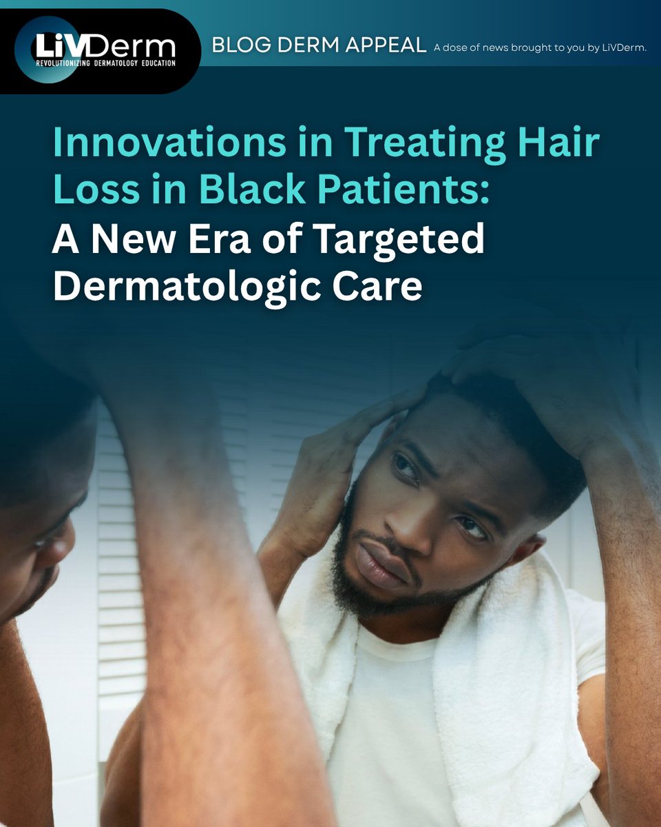 Hair loss continues to be a significant concern for many, but for Black individuals—especially women—the path to treatment can be more complex due to unique biological and sociocultural factors.

🔗 go.livderm.org/3Ir5Qcs

#HairLoss #HairLossTreatment #LiVDerm