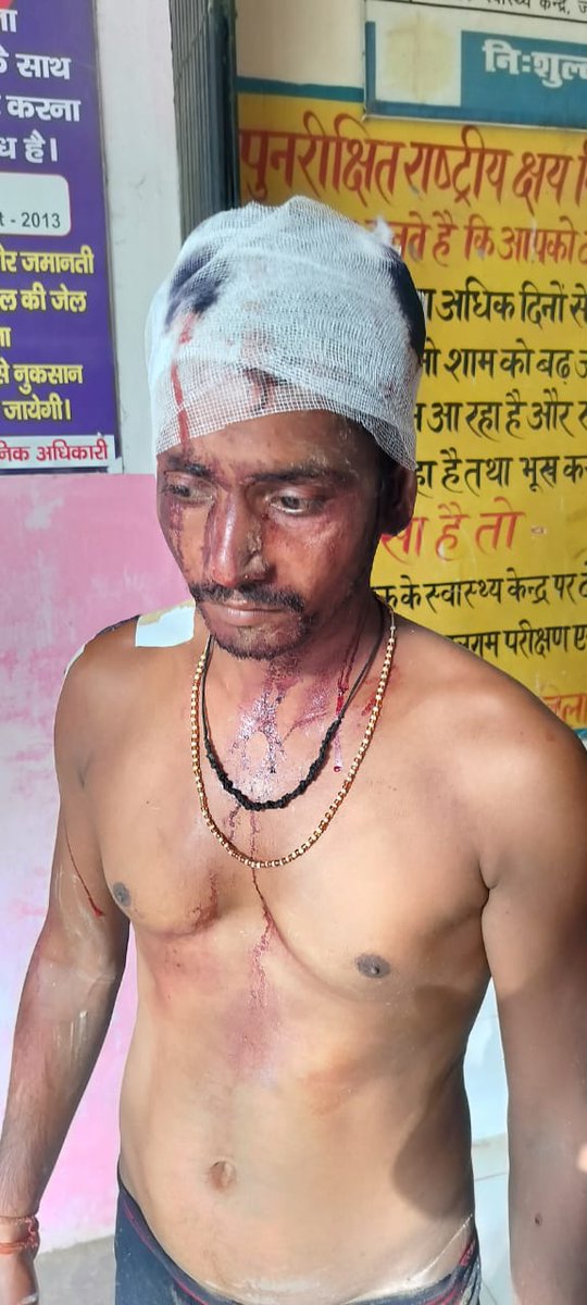 FastInformatio8's tweet photo. बाराबंकी मसौली थाना क्षेत्र में बीज विक्रेता कन्हैया पर चाकू से जानलेवा हमला, सड़क पर लहूलुहान मिले।हमलावर फरार,पुलिस अब तक खाली हाथ खड़ी कभी दुकान से लौटते शख़्स पर वार, कभी राह चलते लोग निशाना!आख़िर मसौली में सुरक्षा सिर्फ़ नाम की ही क्यों रह गई है?
@Barabankipolice @Uppolice https://t.co/TyEkGlecJU