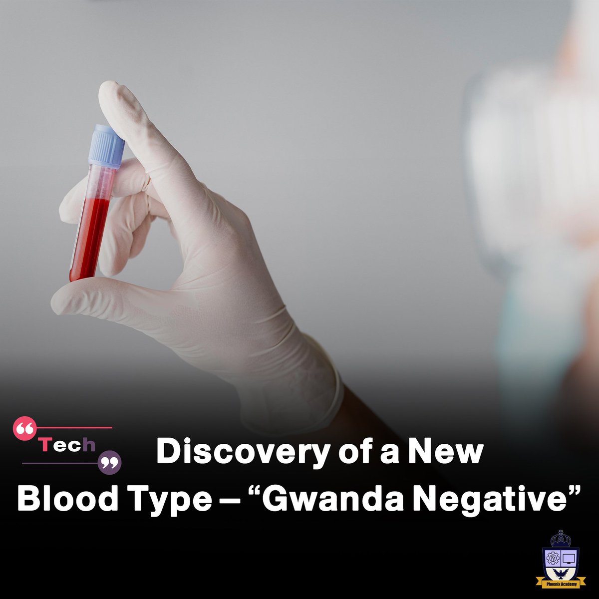 Academy_Phx's tweet photo. A French woman has been identified as the world’s first and only known case of a novel blood type system, now named “Gwanda negative.” This marks the 48th recognized blood group and could significantly impact transfusion practices and genetic blood research

#science #Discovery https://t.co/UeI1eKcKOj